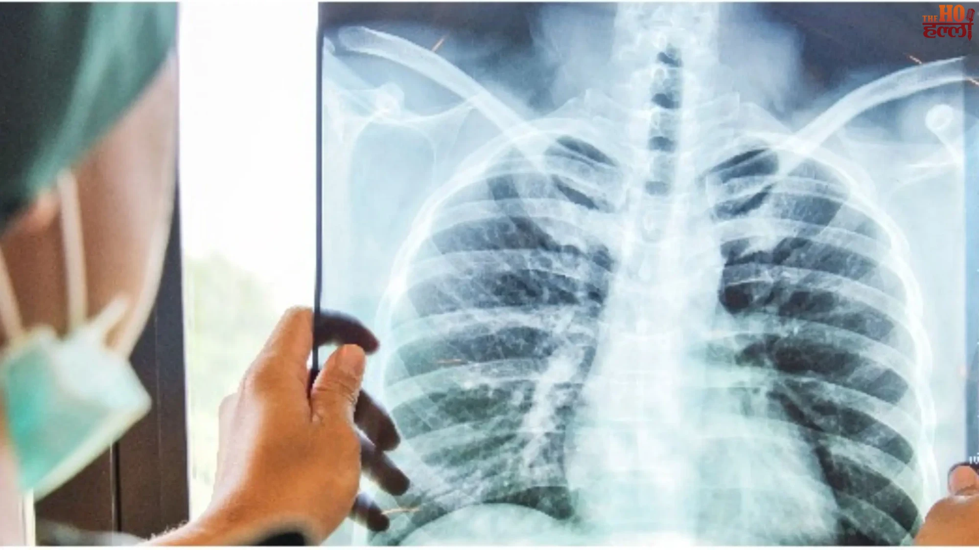 Deadly Lung Disease Know Symptoms and Risks