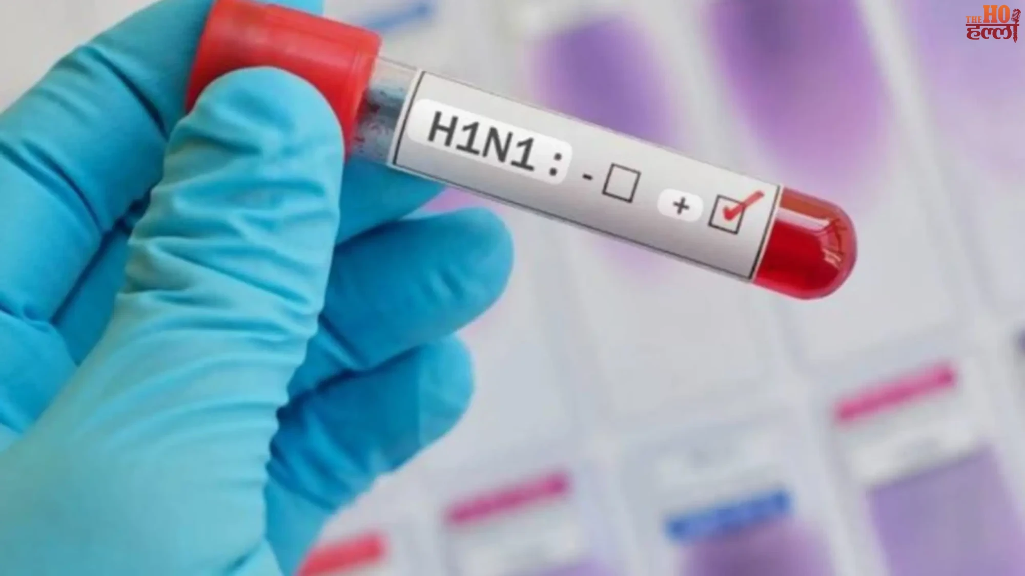 lucknow-swine-flu-h1n1-cases-rtpcr-test-rate-fixed-cmo